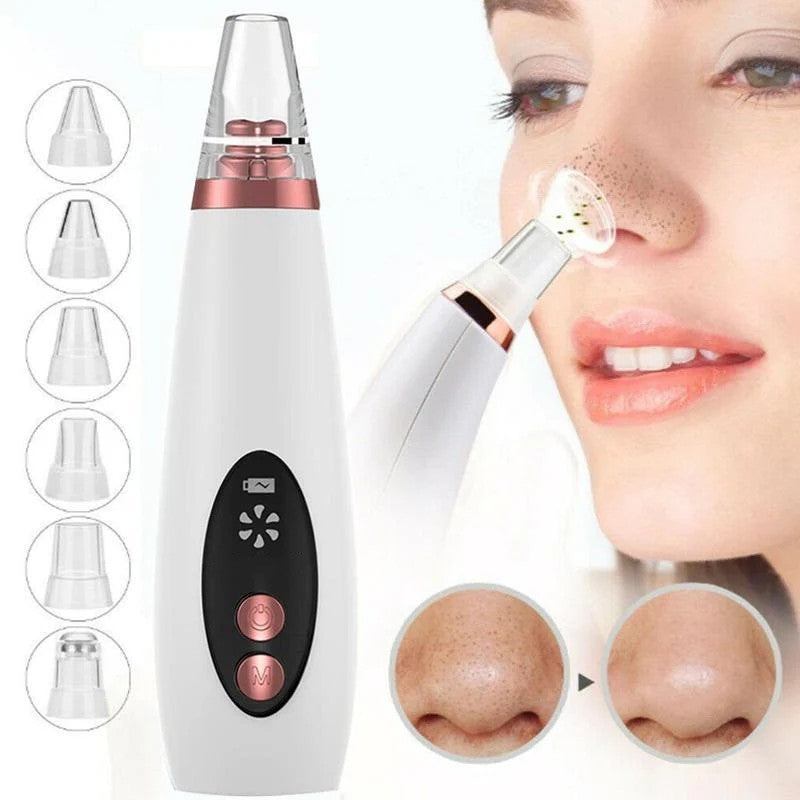 Deep Clean Pore Vacuum – LY-9128 Blackhead Remover for Clearer Skin - GlowSpire
